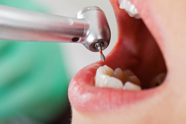 Best Emergency Dental Care for Sports Injuries in Du Quoin, IL